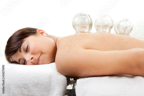 Photo: Female Receiving Acupuncture Cupping Treatment Female Receiving Acupuncture Cupping Treatment