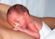 premature baby