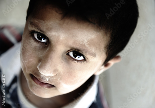 Photo: Portrait of poverty, little boy with sad eyes Portrait of poverty, little boy with sad eyes