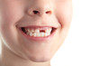 Baby teeth.
