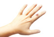 Foto: hand with warts isolated on white background hand with warts isolated on white background