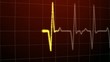 ECG - HeartBeat Monitor
