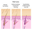 Hair loss process, eps8