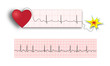 Ticking cardiac time bomb 2 strips