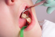 Photo: Mouth, tooth and dental tool in closeup Mouth, tooth and dental tool in closeup