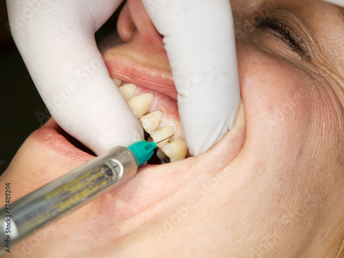 Photo: Mature lady receive local anesthesia Mature lady receive local anesthesia