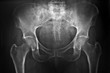radiografia del bacino