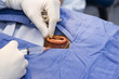 Foto: Surgeon Performing Surgery Surgeon Performing Surgery