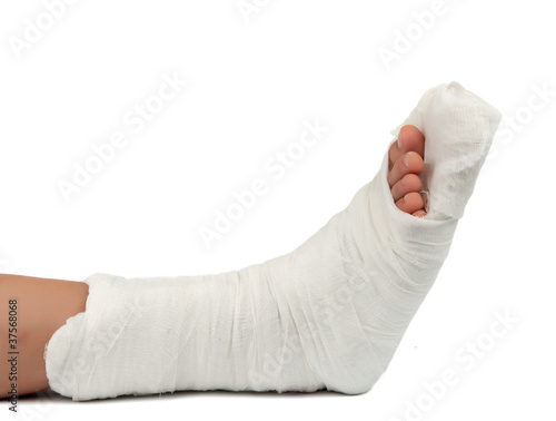 Photo: leg in a plaster cast leg in a plaster cast