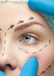 Female face before plastic surgery operation