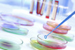 Foto: Analyses médicales - Boites de pétri Analyses médicales - Boites de pétri