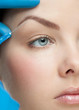 Cosmetic injection of botox