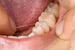 Photo: Mundhygiene Mundhygiene
