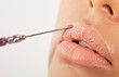 Lip Enhancement Treatment