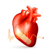 Damaged heart