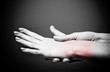 Acute pain in a women wrist