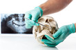 Dentist showing dental caries in a human skull.