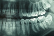 Foto: Dental xray Dental xray