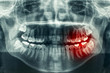 Dental xray