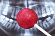 Roter Lolli vor einem geschädigten Gebiss