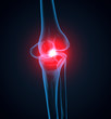 knie schmerzen