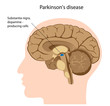 Parkinson's disease, eps8