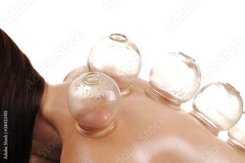 Photo: cupping massage - a young woman cupping massage - a young woman