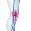 Knie-Schmerzen - 3D Grafik