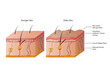 young and old human skin vector illustration