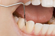 Photo: Mundhygiene Mundhygiene