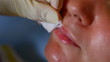 Video: Botox, surgery to increase lip volume Botox, surgery to increase lip volume