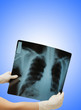 Two hands holding x-ray image of human body