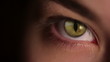 Human eye+cat eyeball