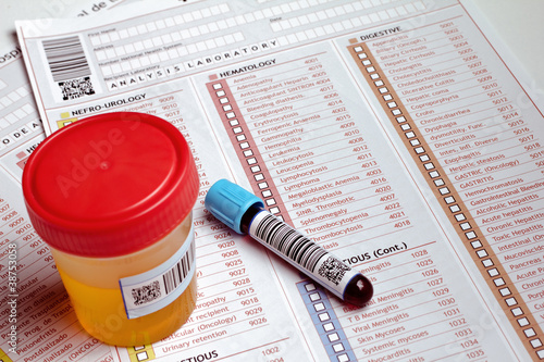 Photo: medical report and test containers to an analytical study medical report and test containers to an analytical study