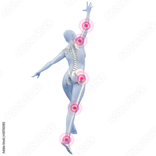 Illustration: Silhouette junger Frau mit Gelenkschmerzen Silhouette junger Frau mit Gelenkschmerzen
