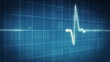 EKG electrocardiogram pulse real waveform