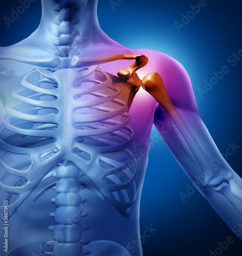 Illustration: Human Shoulder Pain Human Shoulder Pain