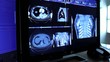 radiologist reviewing cat scan