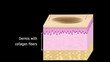 Laser Skin Resurfacing surgery