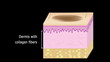 Fractional Laser Skin Resurfacing surgery