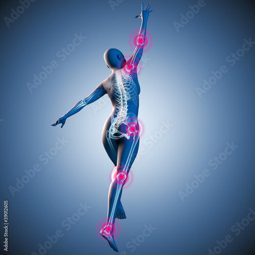 Illustration: Silhouette junger Frau mit Gelenkschmerzen und Skelett Silhouette junger Frau mit Gelenkschmerzen und Skelett