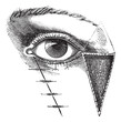 Fig. 180. Blepharoplasty by the method of Dieffembach, vintage e