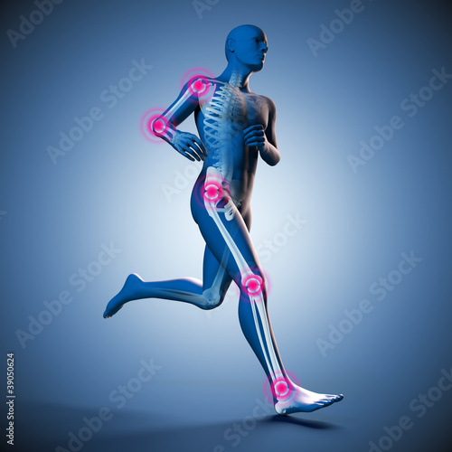 Illustration: Laufender Mann Silhouette mit Skelett und Gelenkschmerzen Laufender Mann Silhouette mit Skelett und Gelenkschmerzen