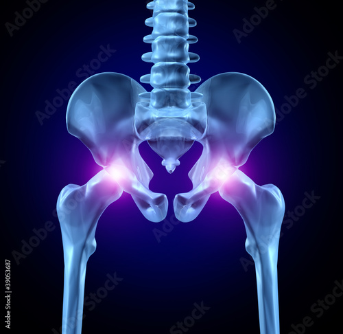 Illustration: Hip Pain Hip Pain