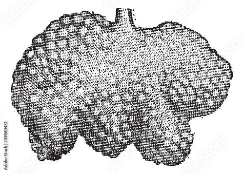 Vector: Fig. 4. Intestine, Brunner's glands or duodenal glands, vintage Fig. 4. Intestine, Brunner's glands or duodenal glands, vintage
