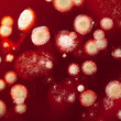 Mold colonies