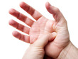 Palm acupressure