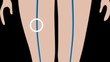 Animation simulation of pulmonary embolism