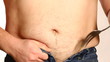 Overweight man