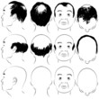 Asian Male Baldness Pattern Asian Male Baldness Pattern